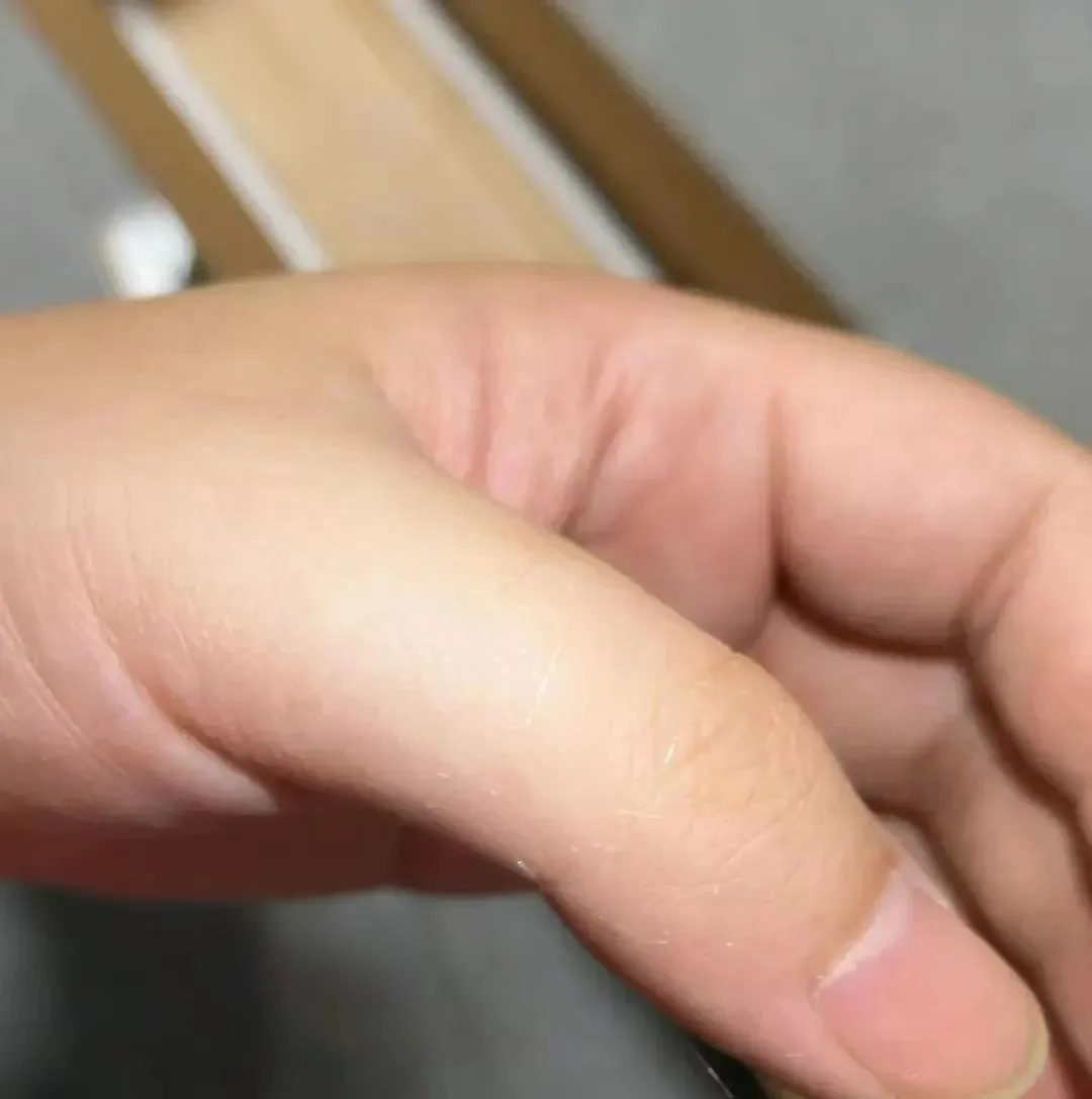 星云助手：网购需警惕！隐形玻璃纤维伤眼事件频发，拆快递要小心