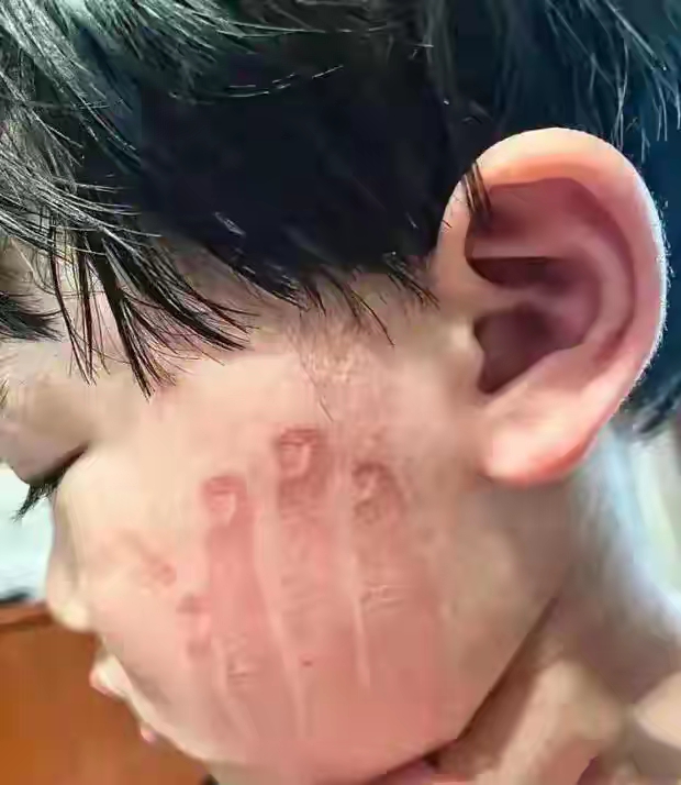 乐多多助手：妈妈被要求扇女儿耳光退货，教育与惩罚的社会争议