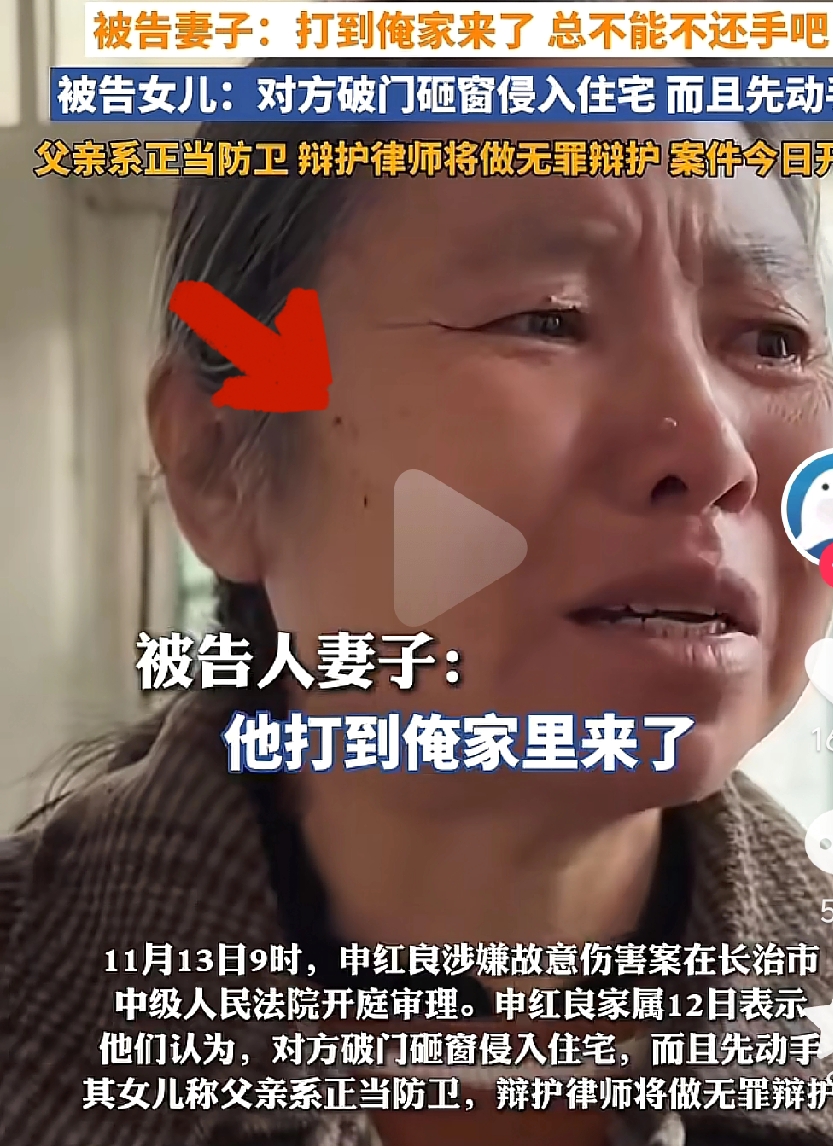 小店管家出评软件：政协委员狗咬邻居事件，道德与法律的双重缺失