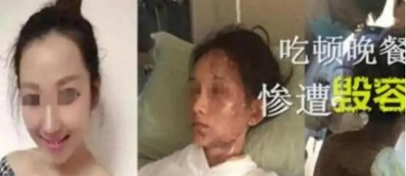 拼多多改销量：火锅店服务纠纷，一句话惹祸致顾客重伤，教训深刻！