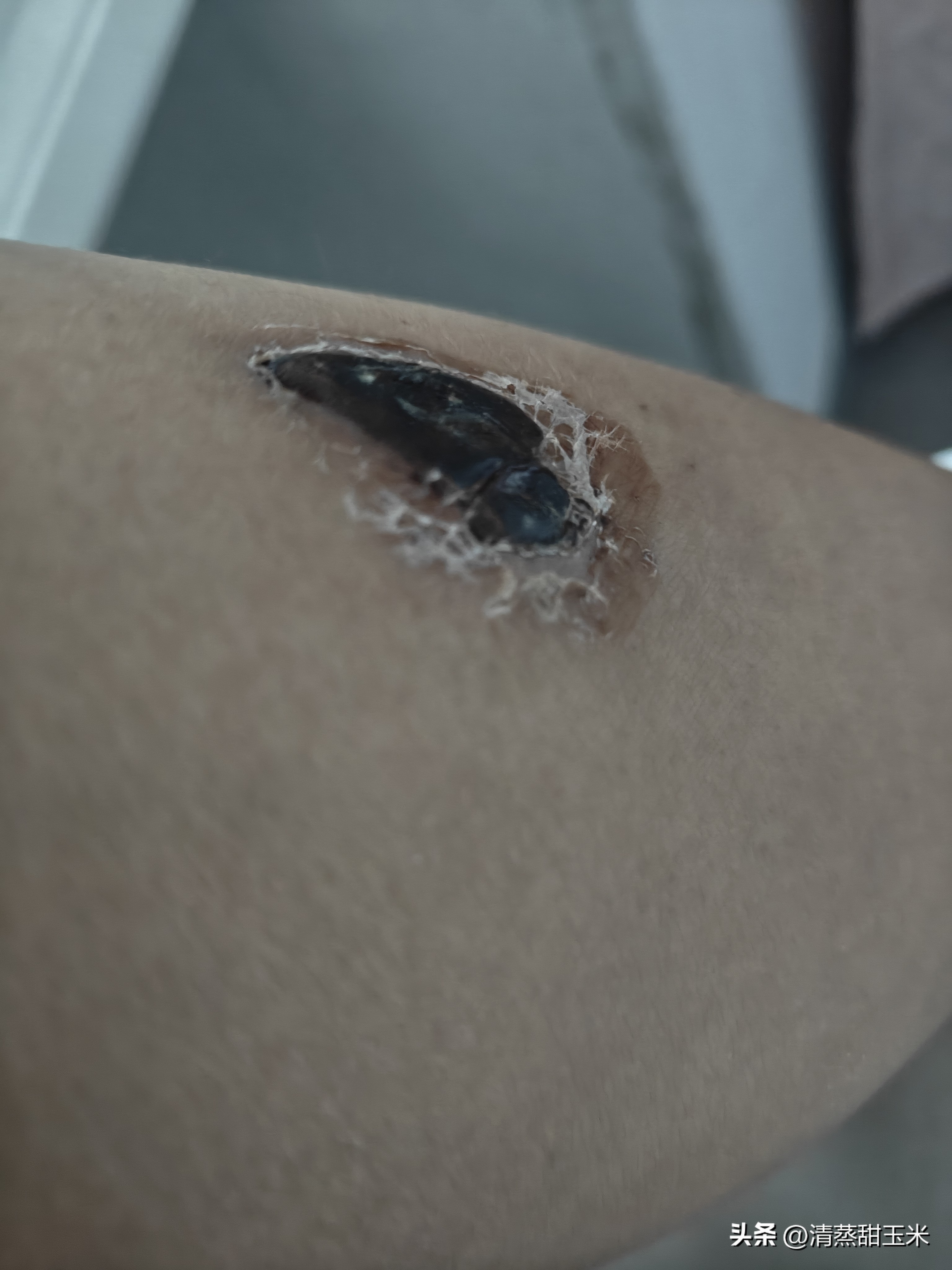 Q助手：外卖兼职的风险与宝妈转型自媒体之路