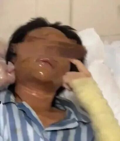 超评助手入口：女主播遭伪装炸弹包裹袭击 面部重伤引关注警方介入调查