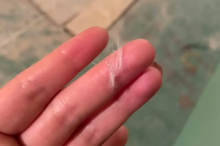 星云助手：网购需警惕！隐形玻璃纤维伤眼事件频发，拆快递要小心