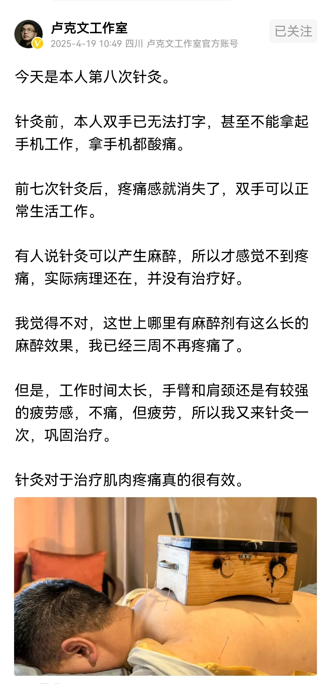 爆款助手小号：针灸治疗的真实体验，卢克文与外甥女的康复故事分享