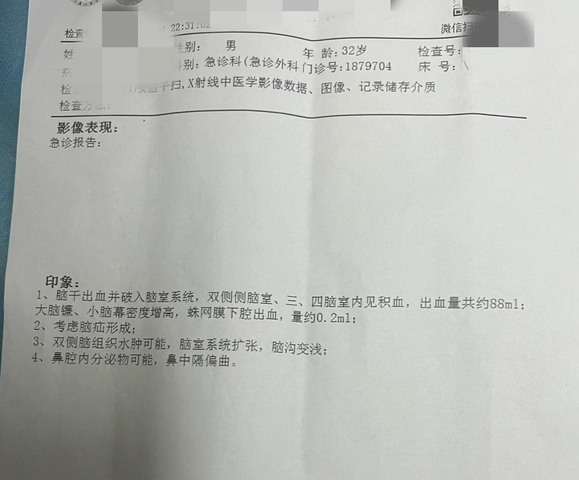 拼多多出评软件：网红主播阿奎突患脑溢血离世，留下四个年幼孩子，警示关注健康与工作压力