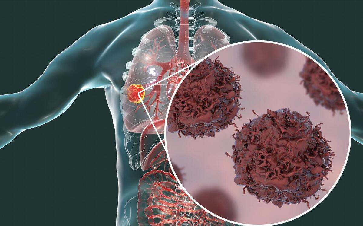 快火助手：疾病自愈迷思，90%疾病需重视治疗，忽视或酿成严重后果