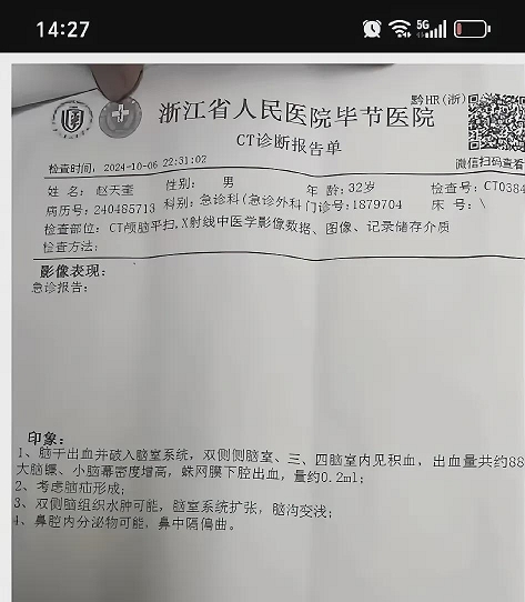 快火助手卡密：阿奎脑出血去世引发的健康警示，珍惜生命，关注身体健康！