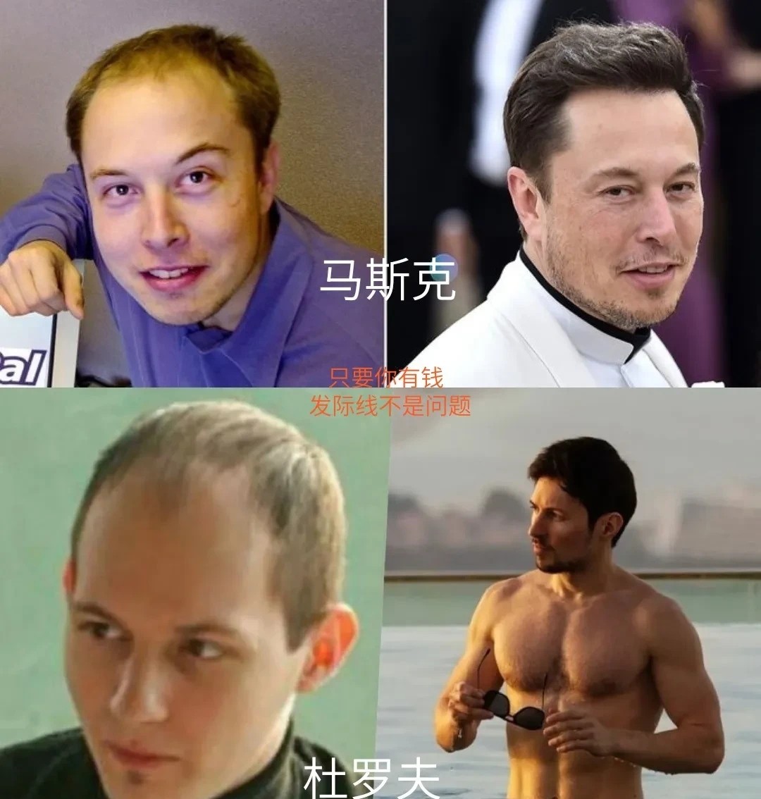 番茄管家出评软件：成功人士的发际线变化，财富与压力背后的幽默解析